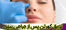 تزریق کورتون پس از جراحی بینی