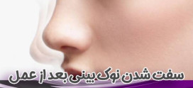 سفت شدن نوک بینی بعد از عمل