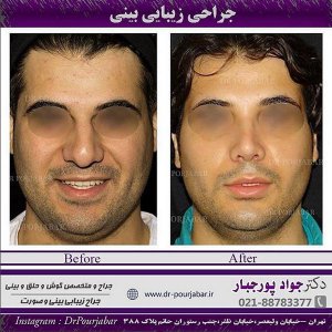 جراح بینی تهران