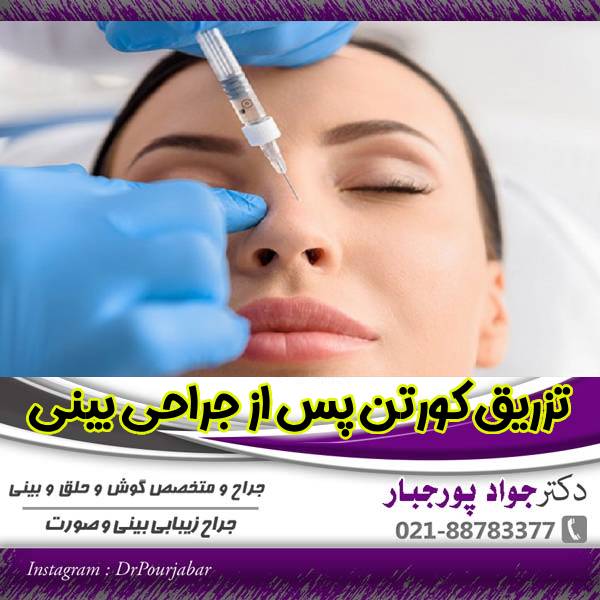 عکس ترزیق کورتون بعد جراحی بینی - دکتر جواد پور جبار
