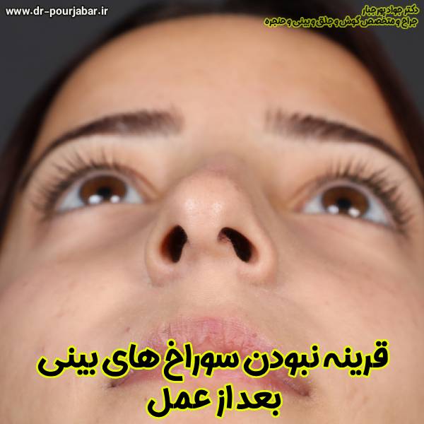 قرینه نبودن سوراخ های بینی - دکتر جواد پورجبار