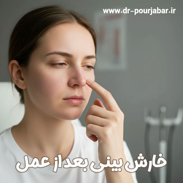 خارش بینی بعد از عمل + دکتر جواد جبارپور