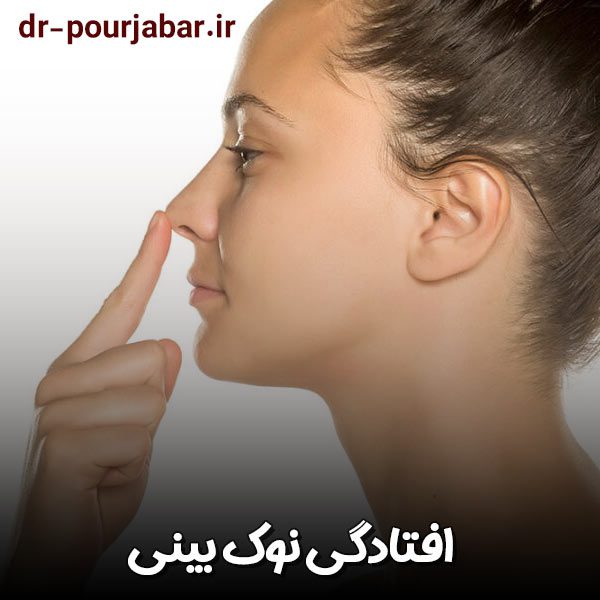 افتادگی نوک بینی