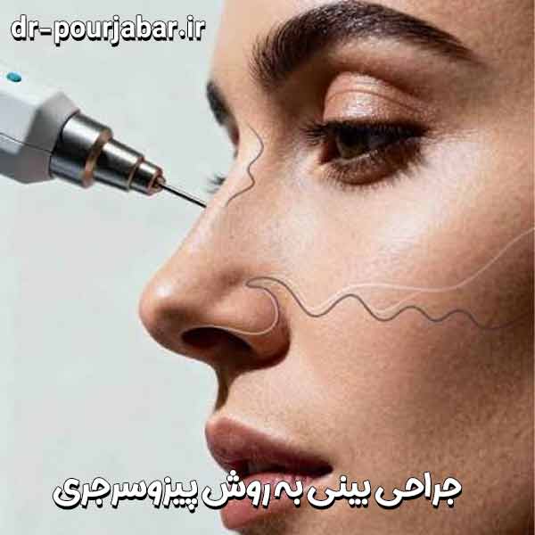 جراحی بینی به روش پیزوسرجری
