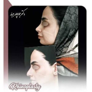 جراحی-بینی-203 (1) (1)