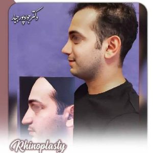 جراحی-بینی-204 (1) (1)